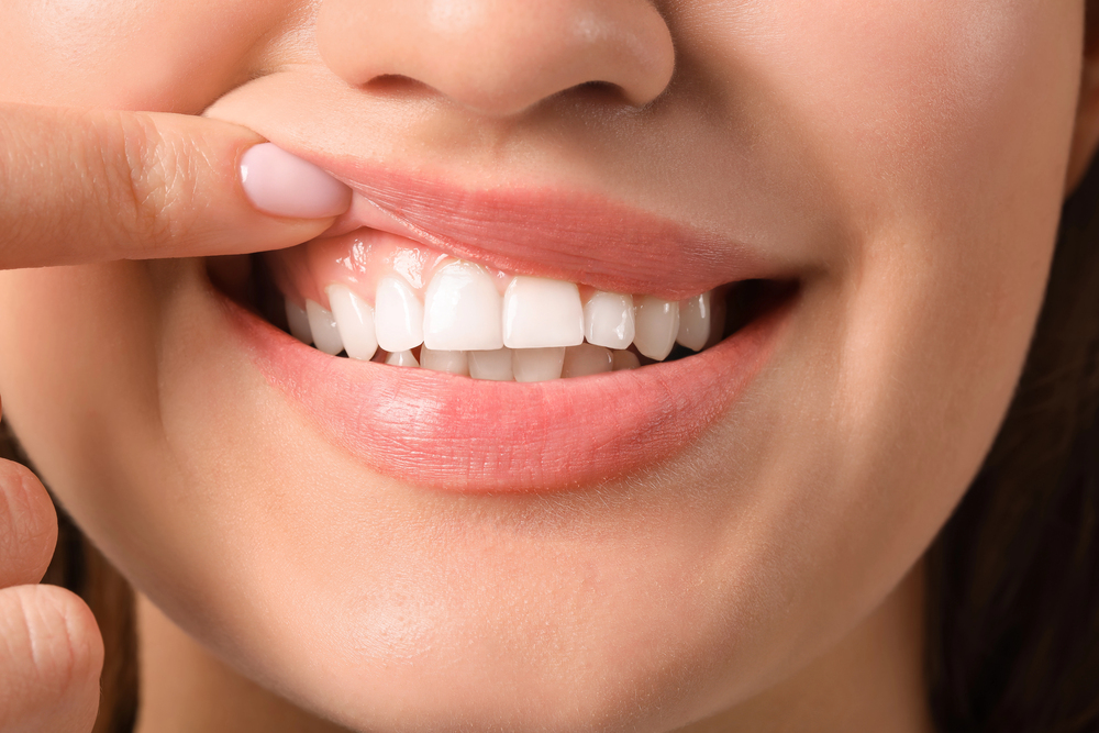 periodontal health
